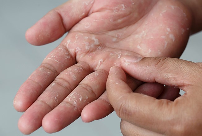 آموزش پاک کردن چسب قطره ای از روی پوست و هر چیز دیگری 